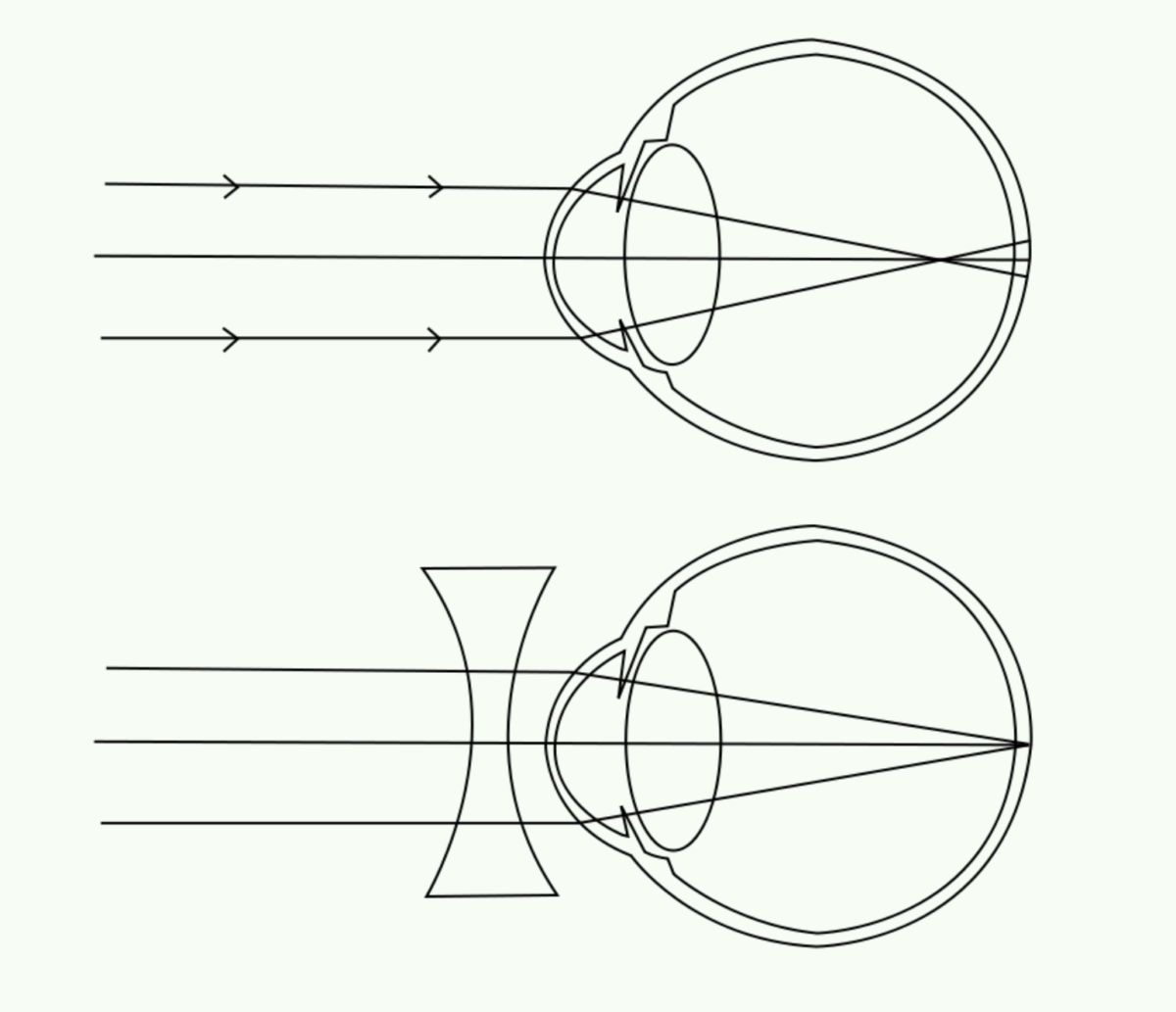 Trouble De La R Fraction Sevision